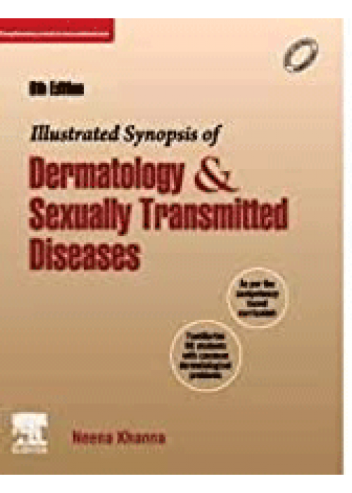 Illustrated Synopsis of Dermatology and Sexually Transmitted Diseases-Neena Khanna